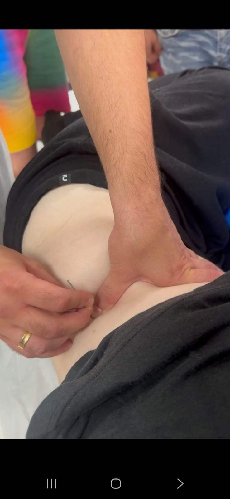 Dry Needling Level 1